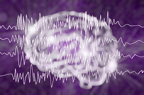 Approximately 10 per cent of people will experience at least one seizure during their lifetime. Photo: Kateryna Kon / Science Photo Library via Getty Images