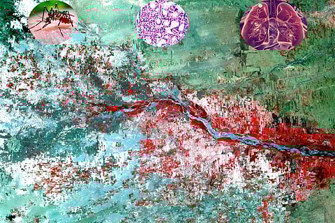 जलवायु परिवर्तन के चलते लोगों में 58 फीसदी तक रोग तथा रोगाणु बढ़े:अध्ययन