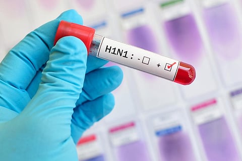 The COVID-19 pandemic has caused people to become more sensitised and willing to get tested for other respiratory illnesses, like swine flu. Photo: iStock