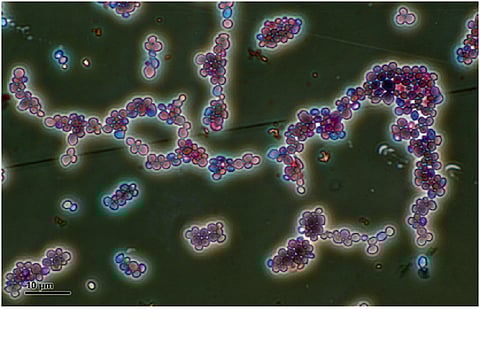 Named CSA6, the gene has been identified in Candida albicans: Photo: ISW