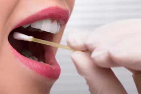 वैज्ञानिक ने लार के नमूने के लिए बनाई किट, तपेदिक, स्तन कैंसर जैसी बीमारियों की जांच में अहम