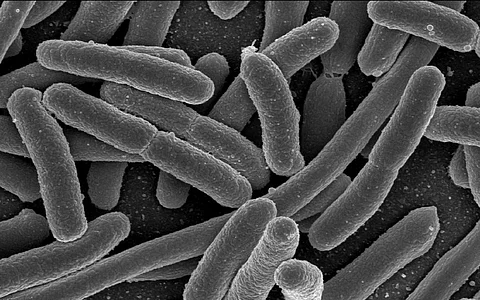 Common bacterial infections were the second-leading cause of death in 2019, according to the analysis. Photo: Wikimedia Commons