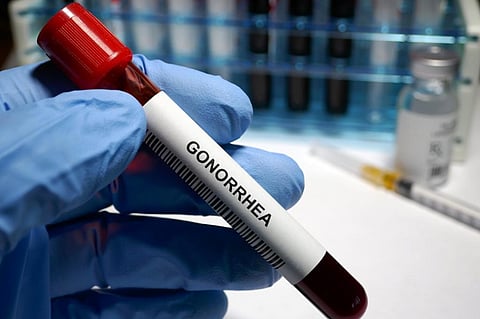 Over 60 per cent of Neisseria gonorrhoea infections, a common sexually transmitted disease, show resistance to ciprofloxacin. Photo: iStock