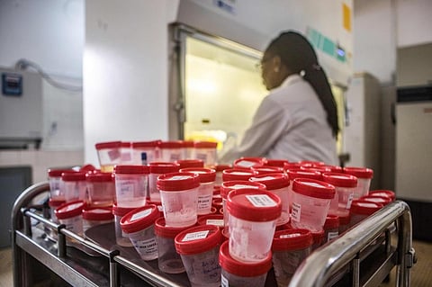 Scientist analysis flasks of saliva of TB patients. Photo: Yanick Folly / AFP via Getty Images