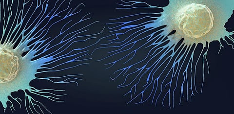 How cancer cells move and metastasize is influenced by the fluids surrounding them