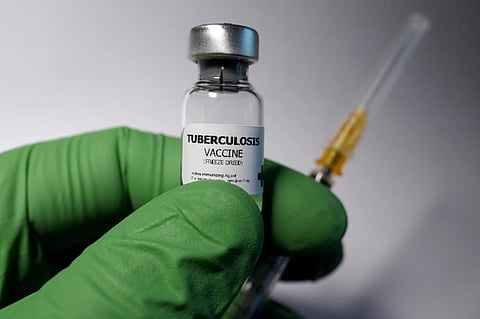 No new TB vaccines have been licensed in a century. Bacillus Calmette-Guérin (BCG) vaccine, developed in 1921, is the only licensed TB vaccine at present. Photo: iStock