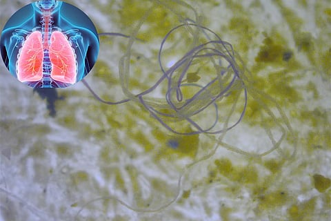 फोटो साभार : विकिमीडिया कॉमन्स, एम. डैनी25