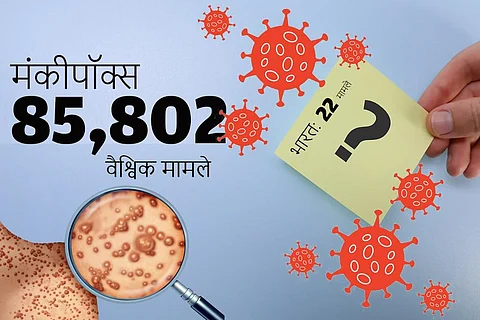 एमपॉक्स अपडेट: स्वीडन में मिल चुके हैं 260 संक्रमित, नीदरलैंड में भी 1260 पर पहुंचा आंकड़ा
