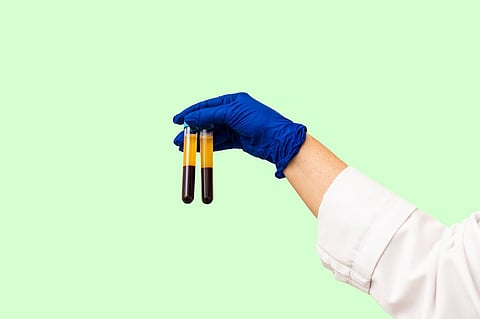 Pathology analyses bodily fluids and tissues using a variety of methods. Photo: Alvaro Lavin/Moment via Getty Images