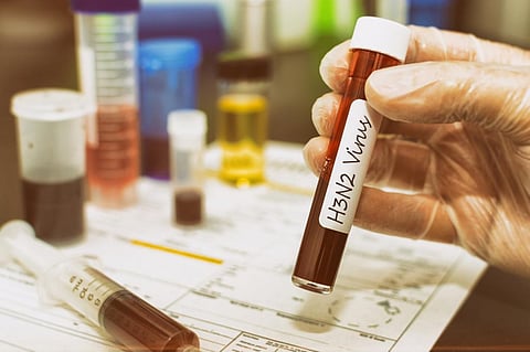 Of the last five quite severe influenza seasons, three were caused by H3N2, research has shown. Photo: iStock