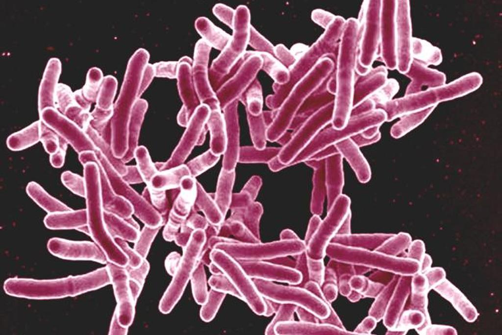 फोटो साभार : विकिमीडिया कॉमन्स, एनआईएआईडी