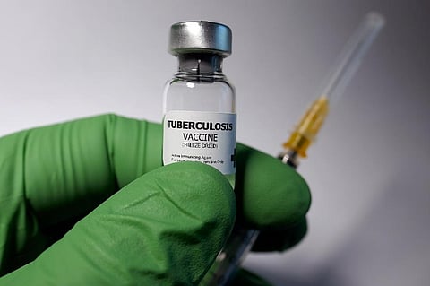 While the bacille Calmette-Guérin (BCG) vaccine has been around for over eight decades and is a key component of national childhood immunisation programmes in several countries, it doesn’t help much with limiting disease transmission. Representative photo: iStock.