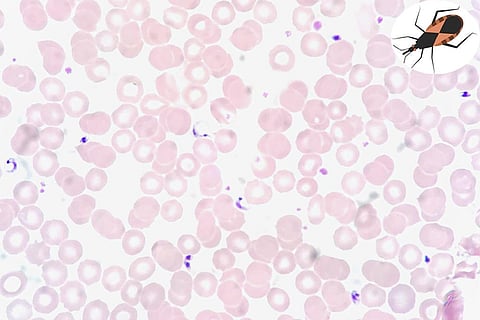 फोटो साभार : विकिमीडिया कॉमन्स,एड उथमन