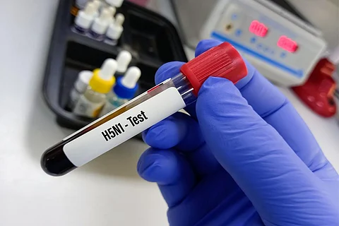 पहला मौका है जब चिली में इंसानों में बर्ड फ्लू का मामला सामने आया है; फोटो: आईस्टॉक