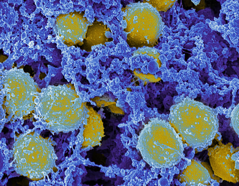 Removing antimicrobial resistance from the WHO’s ‘pandemic treaty’ will leave humanity vulnerable to future pandemics