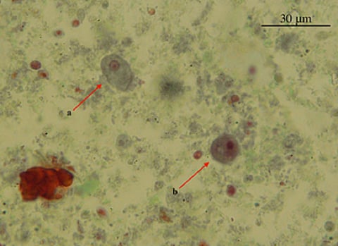 Microscopic view of Entamoeba moshkovskii. Photo: Prevalence and molecular characterization of Entamoeba moshkovskii in diarrheal patients from Eastern India / PLOS Neglected Tropical Diseases