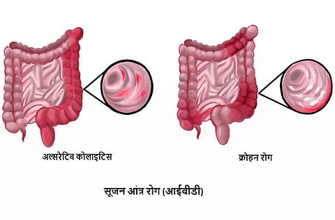 फोटो साभार: विकिमीडिया कॉमन्स, वोल्फपैक बीएमई