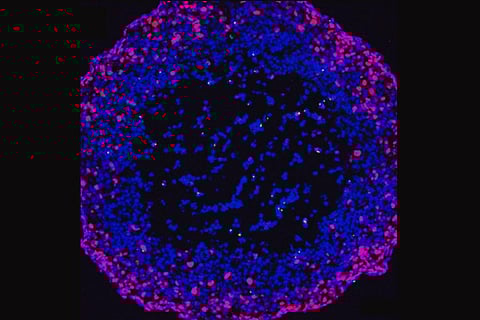 गोलाकार बहुकोशिकीय ट्यूमर में सूक्ष्म और नैनो-प्लास्टिक कणों (एमएनपी) का वितरण। फोटो साभार: केमोस्फेयर्स पत्रिका