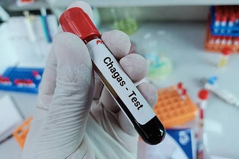 शीघ्र पता लगाना महत्वपूर्ण है क्योंकि संक्रमण के तुरंत बाद उपचार प्रदान किए जाने पर चगास रोग का इलाज संभव है। फोटो साभार: आईस्टॉक