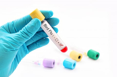 Four-year-old from West Bengal confirmed as second human case of H9N2 bird flu in India