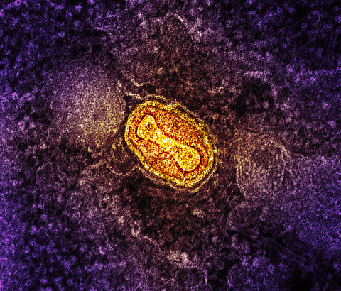 A mpox virus particle (yellow and red) found within an infected cell (purple)