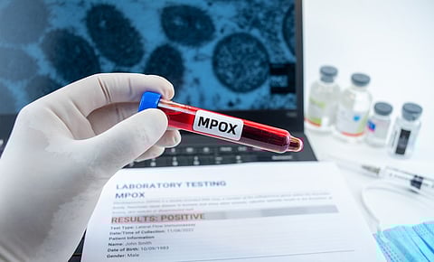 India reports its first case of the deadly clade 1b strain of mpox, becoming the third country outside Africa to do so. The 38-year-old patient from Kerala's Malappuram district had recently returned from the UAE. Kerala is now on high alert.