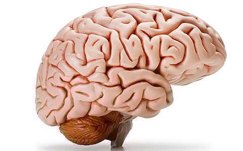 Five simple questions can help spot exaggerated research claims over sex differences in the brain