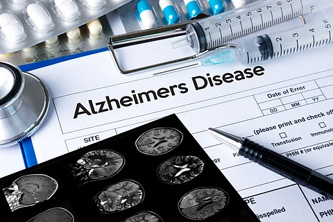 The researchers speculated that viruses may catalyse protein aggregation, depleting essential proteins and their functions, contributing to neurodegeneration