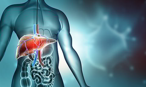 How a liver transplant helped one woman with bowel cancer become disease free