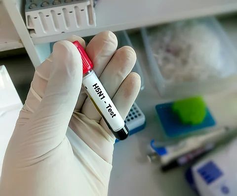 Researchers uncover critical mutations in H5N1 bird flu strain from infected Texan