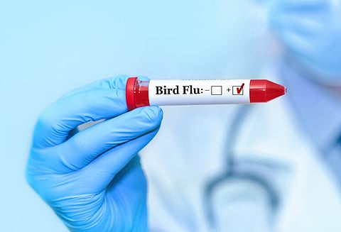UK detects first human case of H5N1 bird flu in 3 years