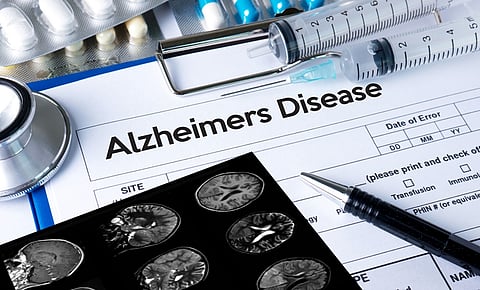 Early-onset Alzheimer’s: new drug shows promise in slowing the disease