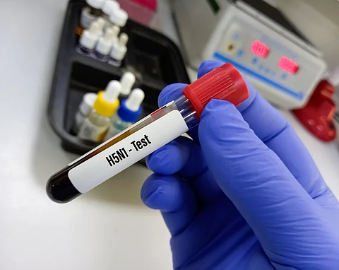Vietnam: Eight-year-old girl diagnosed with H5N1 avian flu with encephalitis
