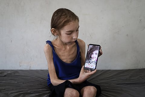 Between pain and deprivation, the Gazan girl Rahaf Ayad battles a rare and unknown illness that has left her unable to walk and caused her hair to fall out, amid a total medical incapacity and an Israeli blockad.jpg