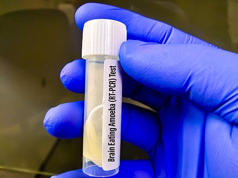 Brain-eating amoeba is Kerala’s new health emergency