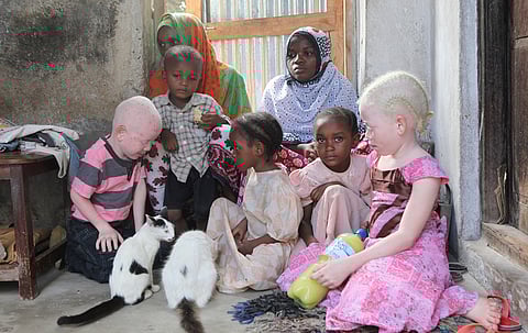 Kenya, Tanzania albinism community lauds WHO, welcomes addition of sunscreen to essential medicines list