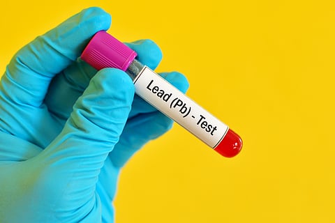 Lead exposure in children costs world $3.4 trillion a year, study warns