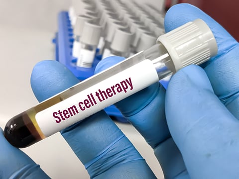 Stem cells sound magical, but they’re not all created equal. Here’s what you need to know