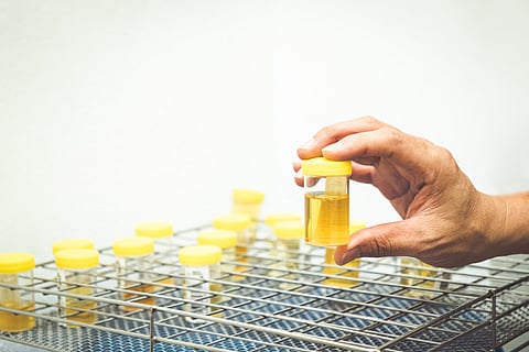 Researchers improve method to generate clean energy from human urine