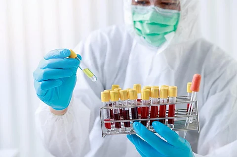 The strength of human biomonitoring lies in its ability to directly quantify the amount of chemicals inside the human body. Photo: iStock