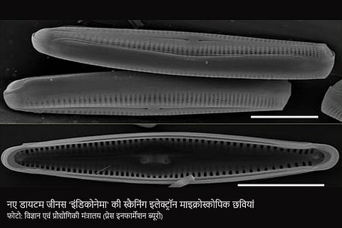 नए डायटम जीनस 'इंडिकोनेमा' की स्कैनिंग इलेक्ट्रॉन माइक्रोस्कोपिक छवियां; फोटो: विज्ञान एवं प्रौद्योगिकी मंत्रालय (प्रेस इनफार्मेशन ब्यूरो)