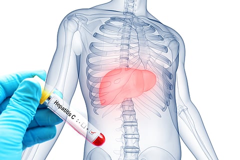 भारत इस बीमारी के मामले में दूसरे स्थान पर है जहां 2022 में हेपेटाइटिस बी और सी के 3.53 करोड़ मामले सामने आए थे। इनमें हेपेटाइटिस बी के 2.98 करोड़ और हेपेटाइटिस सी के 55 लाख मामले शामिल थे; फोटो: आईस्टॉक
