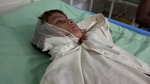 वन्यजीव के हमले में घायल महसी क्षेत्र का एक पीड़ित, फोटो : सीएसई