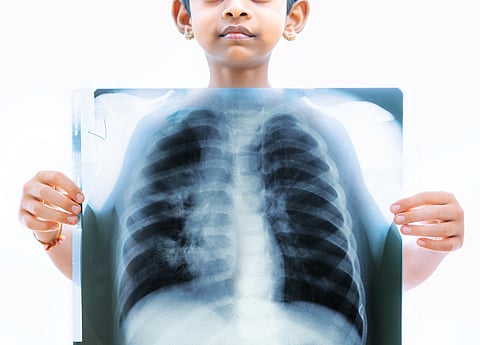 जानलेवा वायु प्रदूषण : गर्भ से बुजुर्ग तक कोई सुरक्षित नहीं