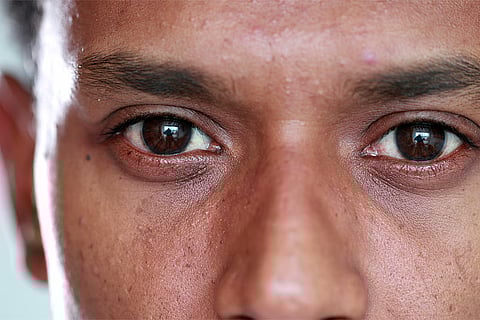 दुनिया के 27 देश अब तक ट्रेकोमा से उबर चुके हैं; प्रतीकात्मक तस्वीर: आईस्टॉक