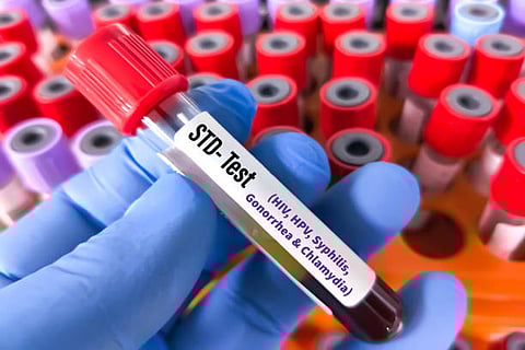 डब्ल्यूएचओ ने चेतावनी दी है कि गोनोरिया, एक सामान्य यौन संचारित संक्रमण (एसटीआई), अब तेजी से एंटीबायोटिक दवाओं के प्रति प्रतिरोधी हो रहा है।