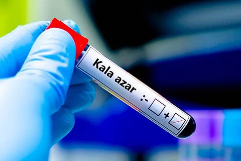 विसरल लीशमैनियासिस, जिसे कालाजार भी कहा जाता है, भारत में अब उन्मूलन के अंतिम चरण में है।