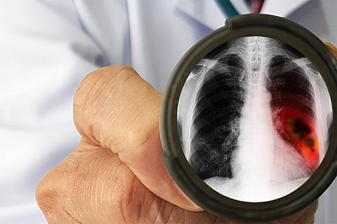 प्रतीकात्मक तस्वीर: आईस्टॉक