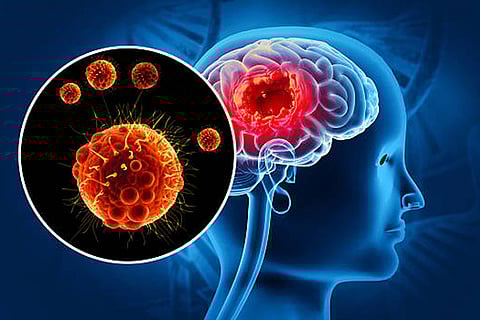 विश्व स्वास्थ्य संगठन (डब्ल्यूएचओ) के मुताबिक, मेनिनजाइटिस मस्तिष्क और रीढ़ की हड्डी के चारों ओर के ऊतकों में होने वाली सूजन है।