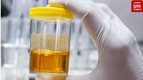 why urine is yellow colour